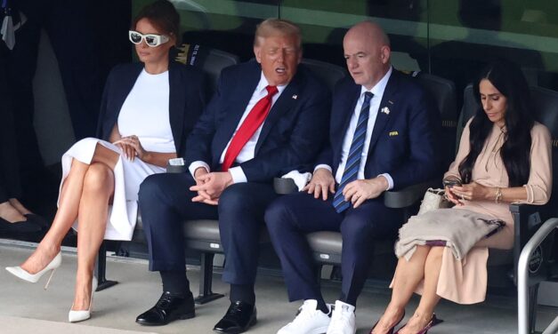 Trump diagnoses chronic venous insufficiency