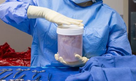 Increased control leads to an improved organ transplant system