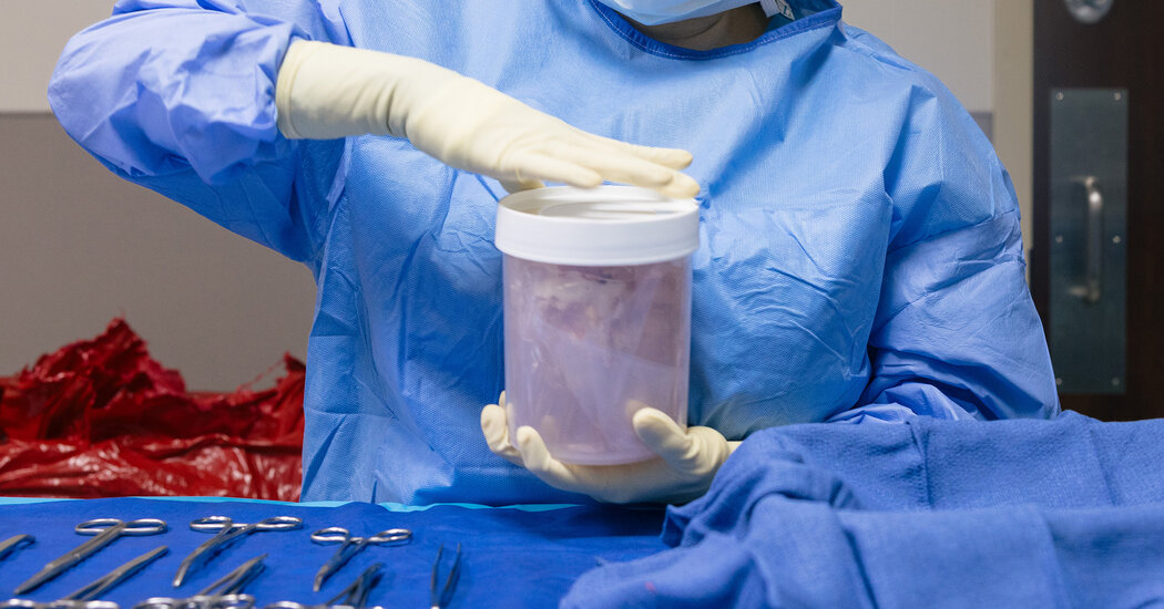 Increased control leads to an improved organ transplant system
